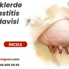 İneklerde Mastitis Tedavisi